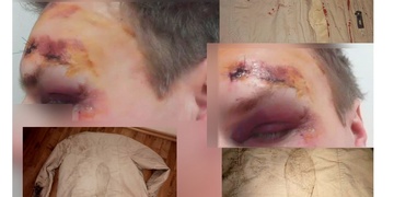 Pomozte! Muže zbili, zkopali a útočník se tím jen dobře bavil