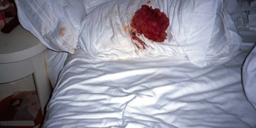 Násilníci vnikli do mužovy ložnice a zbili ho v posteli