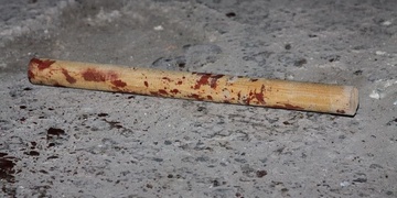 Pomozte pátrat po pachateli: Na Borech zbili muže baseballovou pálkou, skončil v nemocnici