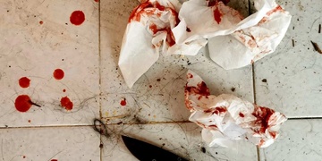 Muže pobodal teprve devatenáctiletý mladík