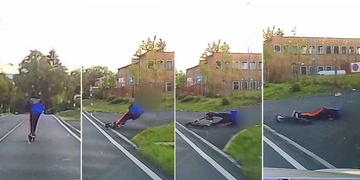 Tak tohle muselo hodně bolet!