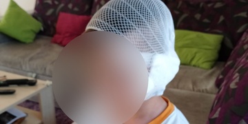 Pětiletého Vašíka na dětském dni napadl a vážně zranil pes