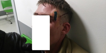 Zraněný opilec se potácel nádražím