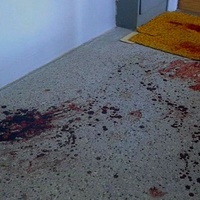 Poláci se porvali na ubytovně, jeden druhého pořezal