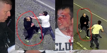 Bitka na Americké - poznáte napadeného muže?