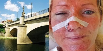 Obětmi násilí mezi Čechy a Ukrajinci jsou bohužel nevinné ženy