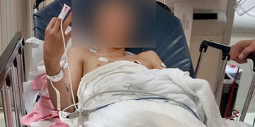 Na Slovanech u bazénu tři útočníci zbili dítě