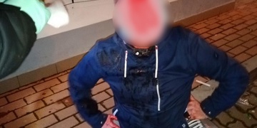 Odchod manželky vyřešil rozřezanou hlavou