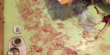 Nepříčetná matka se pokusila podříznout malou dcerušku a pak sebe