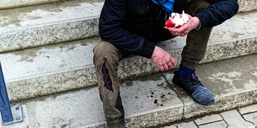 Jeden si v opilosti rozbil hlavu, druhý viděl špióny a bojoval o svůj život