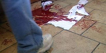 Lahví přes hlavu - pátráme po svědcích: Viděli jste toto napadení?